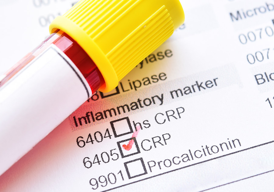 O que é a Proteína C Reativa (PCR)? Prozis O que é a Proteína C Reativa (PCR)? Prozis